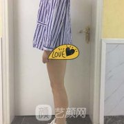 整形美容医院正规吗？吸脂手术价格及案例公开展示
