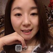 绵阳口腔医院价格表收费标准|上嘴唇前突手术果展示