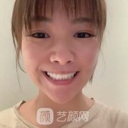 第四军医大学口腔医院价格价目表|种植牙案例盘点