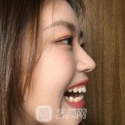 医科大学附属口腔医院价格表|牙齿矫正案例一览