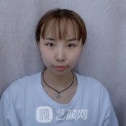 珠海市人民医院整形科做眼睛好不好？看价格表和双眼皮术后果图吧~