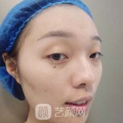 阜阳市第五人民医院整形科价格表|双眼皮果查看