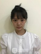 北京鹏爱整形医院价格表2021预览！专家隆鼻案例果展示