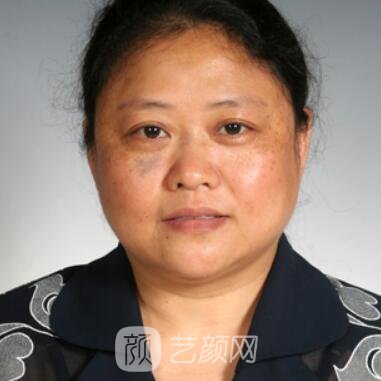 胡黎萍