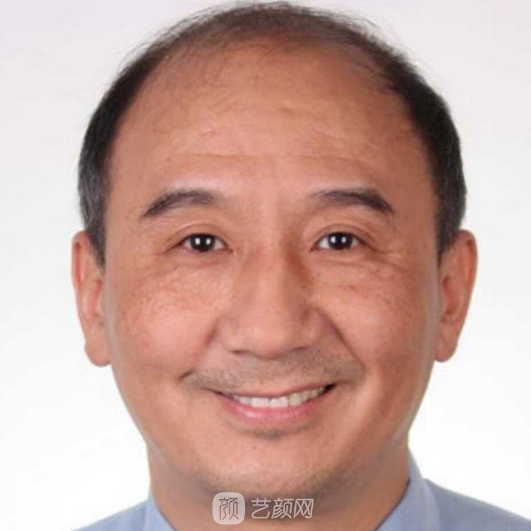 王非