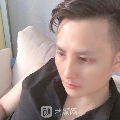 熊进