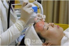 成都周仪做鼻修复技术怎么样？靠谱吗？