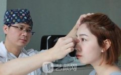 成都鼻修复哪个医生做的好?哪位医生技术更好。