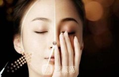 自体脂肪面部填充多少钱?什么是自体脂肪面部填充?