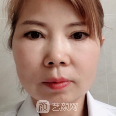 刘静薇