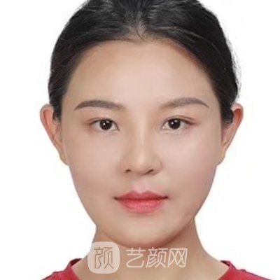 秦菲菲