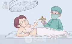 大腿抽脂凹凸不平哪位专家修复好？怎么修复的？