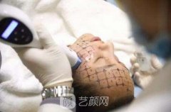 热玛合哪些人，20岁的人能不能做热玛吉？