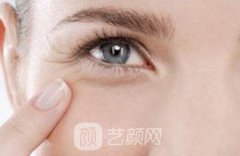 这些去除鱼尾纹的方法，你都知道吗？美容小知识