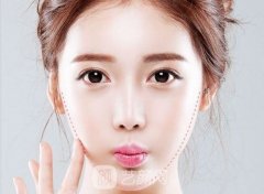 怎么纹眼线才好看，恢复需要多长时间