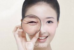 鱼尾纹出现的原因以及预防措施!一起来学习一下吧