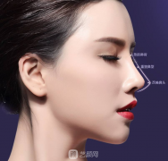 什么是短鼻矫正，重庆做短鼻矫正有哪些方法?