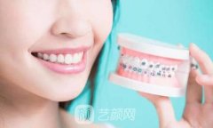 牙齿外突怎么办？牙齿正畸帮你找回自信！