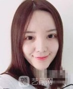 广州玻尿酸丰下巴&玻尿酸丰下巴护理要点!