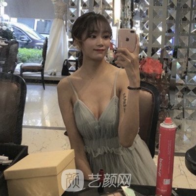 長沙劉超峰醫生做鼻修復怎么樣？2022招牌案例公布