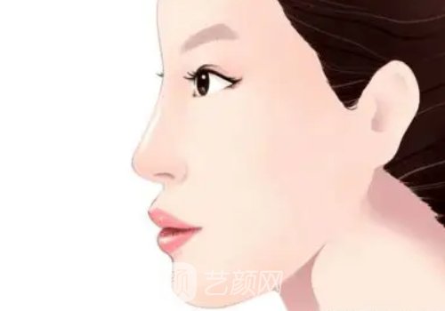 北京纪东辰做隆鼻靠谱吗