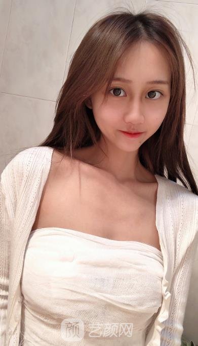 水滴状胸型图片,真人假体隆胸案例片鉴赏,超美_艺颜网