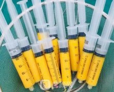 ASCC脂肪填充技术什么？抗衰领域的重大突破