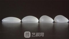 水滴奶图片，水滴假体和圆形假体哪个好？
