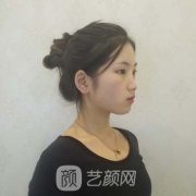 杨丽双眼皮案例，看得见的变化特别大，漂亮眼眸速成记