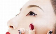 濡白天使隆鼻会移位吗？会产生透光问题吗？