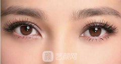 为什么不建议做卧蚕手术？做卧蚕手术多久可以恢复？