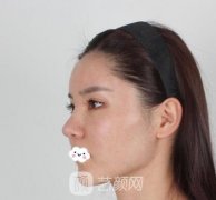磨骨手术过程真实图片，