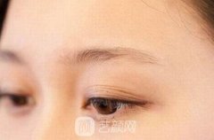 韩式提眉效果好不好？韩