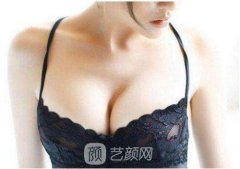 蜜桃假体隆胸效果好不好