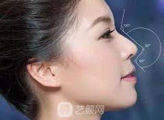 注射隆鼻后注意事项有哪