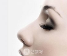鼻尖肥大整形靠谱吗|鼻尖