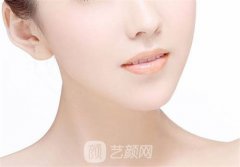 自体脂肪短下巴整形效果