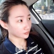 找黄志祥医生做了自体软