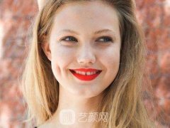 玻尿酸注射丰面颊的效果