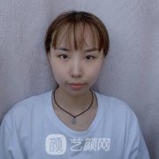 张余光修复眼案例：张医