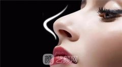 鼻尖缩小手术效果好不好