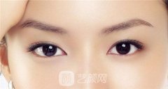 双眼皮全切修复肉条多久