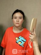 熊猛隆鼻案例：俺也想做