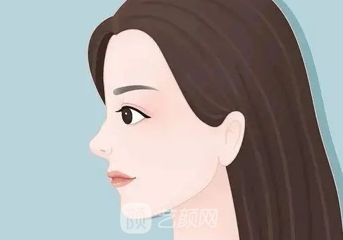 鼻子整形一般多少钱?价格