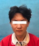 男人隆鼻早已不是什么新