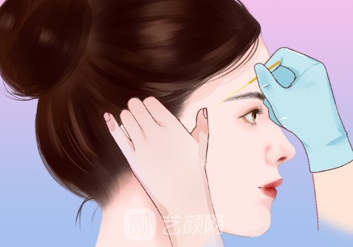 正规医院去眼袋和除皱多
