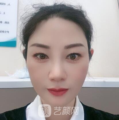 陈佳