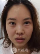 郑州大学第二附属医院杨