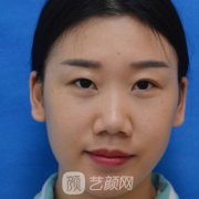 敖健飞双眼皮怎么挂号?形