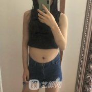 滕州美十美整形怎么样?内